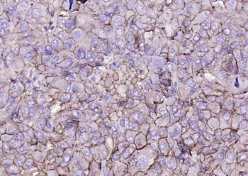 MHC class I Recombinant Rabbit Monoclonal Antibody