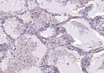 MHC class I Recombinant Rabbit Monoclonal Antibody