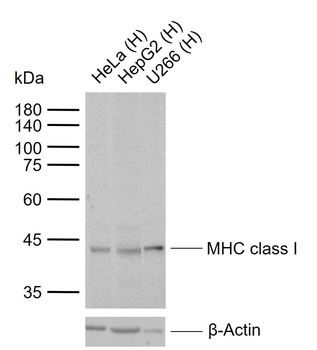 MHC class I Recombinant Rabbit Monoclonal Antibody