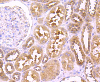 TNFR2 Recombinant Rabbit Monoclonal Antibody