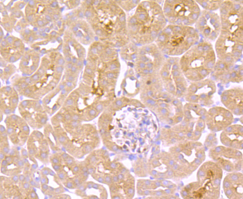 TNFR2 Recombinant Rabbit Monoclonal Antibody