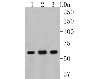 TNFR2 Recombinant Rabbit Monoclonal Antibody