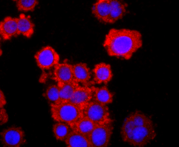 TNFR2 Recombinant Rabbit Monoclonal Antibody