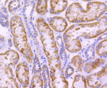 CPT2 Recombinant Rabbit Monoclonal Antibody