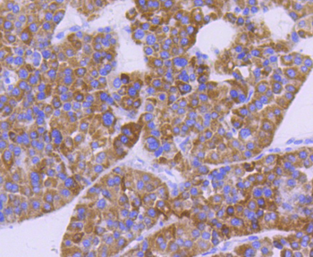 CPT2 Recombinant Rabbit Monoclonal Antibody