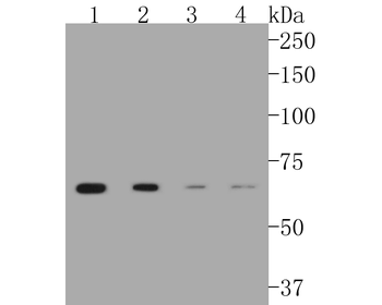 CPT2 Recombinant Rabbit Monoclonal Antibody