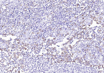 CD163 Recombinant Rabbit Monoclonal Antibody