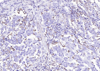 CD163 Recombinant Rabbit Monoclonal Antibody