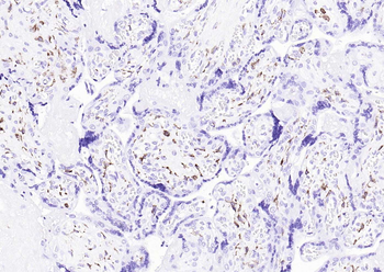 CD163 Recombinant Rabbit Monoclonal Antibody