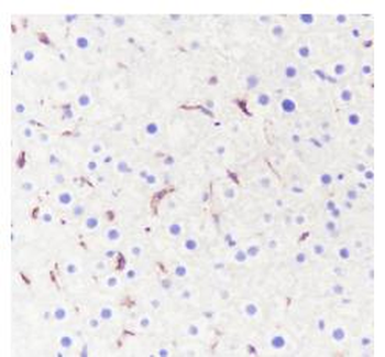 CD163 Recombinant Rabbit Monoclonal Antibody