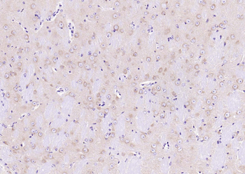 Huntingtin Recombinant Rabbit Monoclonal Antibody
