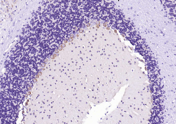 Huntingtin Recombinant Rabbit Monoclonal Antibody