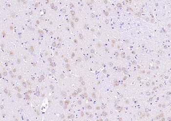 Huntingtin Recombinant Rabbit Monoclonal Antibody