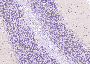 Huntingtin Recombinant Rabbit Monoclonal Antibody