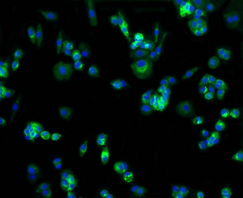GLUT1 Recombinant Rabbit Monoclonal Antibody