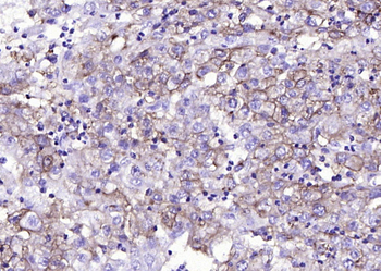 GLUT1 Recombinant Rabbit Monoclonal Antibody