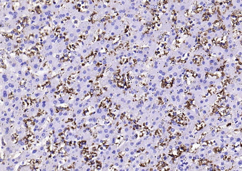 GLUT1 Recombinant Rabbit Monoclonal Antibody