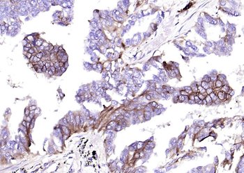 GLUT1 Recombinant Rabbit Monoclonal Antibody