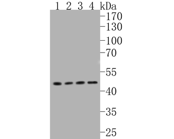 GLUT1 Recombinant Rabbit Monoclonal Antibody