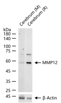 MMP12 Recombinant Rabbit Monoclonal Antibody