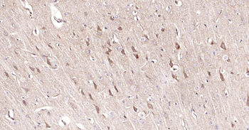 MMP12 Recombinant Rabbit Monoclonal Antibody
