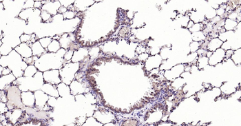 MMP12 Recombinant Rabbit Monoclonal Antibody