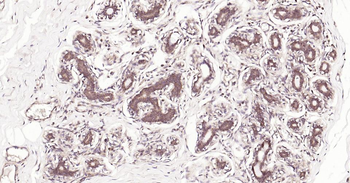 MMP12 Recombinant Rabbit Monoclonal Antibody