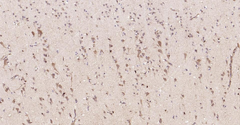 MMP12 Recombinant Rabbit Monoclonal Antibody