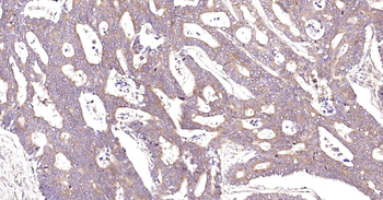 MMP12 Recombinant Rabbit Monoclonal Antibody