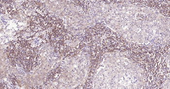 MMP12 Recombinant Rabbit Monoclonal Antibody