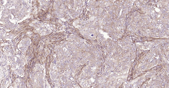 MMP12 Recombinant Rabbit Monoclonal Antibody