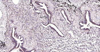 MMP12 Recombinant Rabbit Monoclonal Antibody