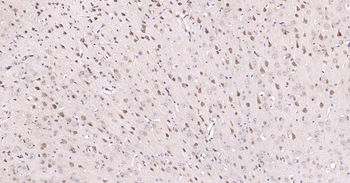 MMP12 Recombinant Rabbit Monoclonal Antibody