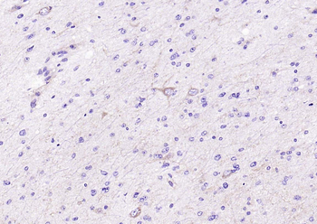 VEGFR1 Recombinant Rabbit Monoclonal Antibody