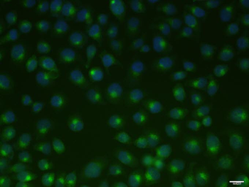 TFRC Recombinant Rabbit Monoclonal Antibody