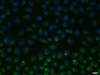 TFRC Recombinant Rabbit Monoclonal Antibody