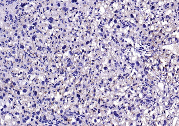 TFRC Recombinant Rabbit Monoclonal Antibody