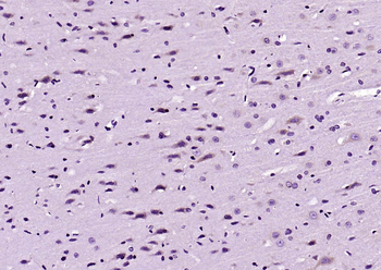 TFRC Recombinant Rabbit Monoclonal Antibody