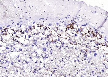 TFRC Recombinant Rabbit Monoclonal Antibody