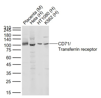 TFRC Recombinant Rabbit Monoclonal Antibody