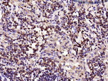 PKC delta Recombinant Rabbit Monoclonal Antibody