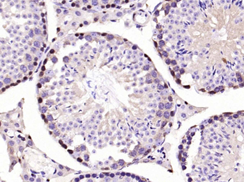 PKC delta Recombinant Rabbit Monoclonal Antibody