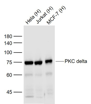 PKC delta Recombinant Rabbit Monoclonal Antibody
