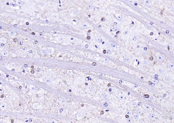 S100 beta Recombinant Rabbit Monoclonal Antibody