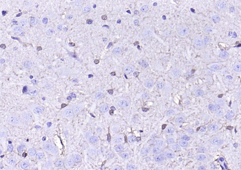 S100 beta Recombinant Rabbit Monoclonal Antibody