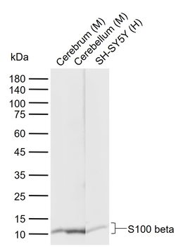 S100 beta Recombinant Rabbit Monoclonal Antibody