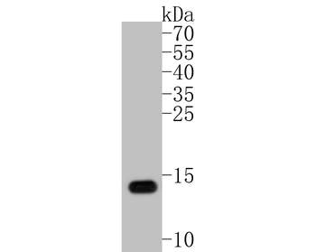 S100 beta Recombinant Rabbit Monoclonal Antibody