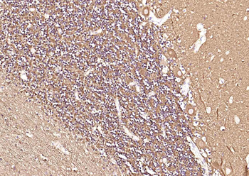 Tubulin beta-III Recombinant Rabbit Monoclonal Antibody