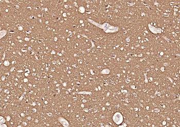 Tubulin beta-III Recombinant Rabbit Monoclonal Antibody