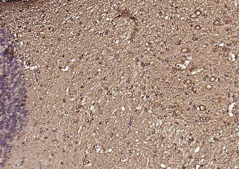 Tubulin beta-III Recombinant Rabbit Monoclonal Antibody